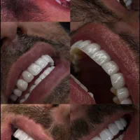 کلینـیک دنـدانپزشکی سـرو اقـساط بلنـد مـدت