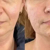 پاور لیفتینگ لاکچری کوین فرانسوی|آرایشی، بهداشتی، درمانی|آبادان, |دیوار