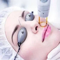 استخدام اپراتور لیزر