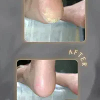 کاشت ناخن و درمان ترک پا|خدمات آرایشگری و زیبایی|مرودشت, ژیان|دیوار