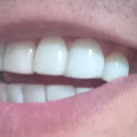 دندان پزشکی