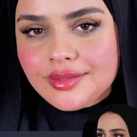 مدل تزریق ژل به تعدادی محدود