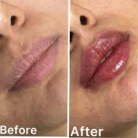 خدمات زیبایی ژل و بوتاکس و چربی