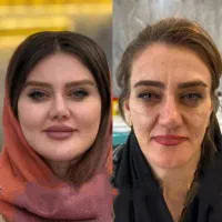 تزریق تخصصی ژل وبوتاکس،چربی،هایفو،نخ،توسط پزشک