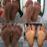 پدیکورتخصصی350آموزش پدیکور پاکسازی دست نوبهار|خدمات آرایشگری و زیبایی|کرمانشاه, |دیوار