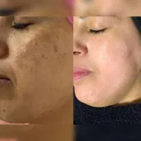 کرمضدلکلاکچری کویین|آرایشی، بهداشتی، درمانی|برازجان, |دیوار