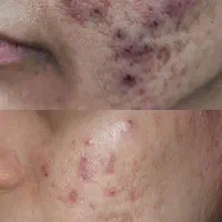 فیشال تخصصی + مشاوره رایگان