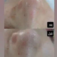 نیازمند دو مدل فیشال اسپا