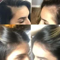 ریزش مو خستت کرده