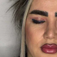 انواع جراحی های زیبایی صورت و بدن