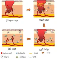 درمان زخم های بستر دیابتی سوختگی لیزرموهای زائد|خدمات آرایشگری و زیبایی|تربت جام, المهدی|دیوار