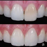 اگهی دو فک بلچینک داخل تهران داندان پزشگیه سرو