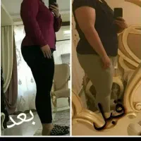 تنها و بهترین روش لاغری ونتیجه قطعی باکرایولیپولیز
