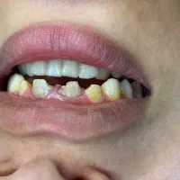 یلدا با تخفیف کامپوزیت|خدمات آرایشگری و زیبایی|ارومیه, |دیوار