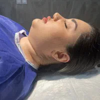 لیپوساکشن غبغب،بوکال فت،فیلرصورت،جوانساز،بوتاکس