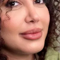 عمل جراحی بینی توسط متخصص زیباییent/ترمیم بینی|خدمات آرایشگری و زیبایی|کرج, چهارصد دستگاه|دیوار