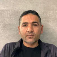 عمل زیبایی گوش (اتو پلاستی)وپلک (بلفاروپلاستی)|خدمات آرایشگری و زیبایی|شیراز, فرهنگ شهر|دیوار