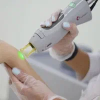 جشنواره پاییزی لیزر با دستگاه کندلا آمریکایی ۲۰۲۴|خدمات آرایشگری و زیبایی|اصفهان, سعادتآباد|دیوار