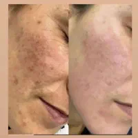 صابون روشن کننده و لایه بردار و کرم مرطوب کننده|آرایشی، بهداشتی، درمانی|سمنان, |دیوار