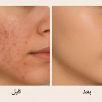 ورکشاپ دمپینگ پوست