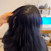 اسکراب اسکالپ