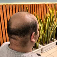 پرپشتی مو ترمیم مو بدون عوارض پروتزمو|خدمات آرایشگری و زیبایی|اصفهان, ملک|دیوار