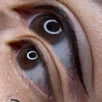 میکروبلیدینگ و شیدینگ|خدمات آرایشگری و زیبایی|تهران, حکیمیه|دیوار