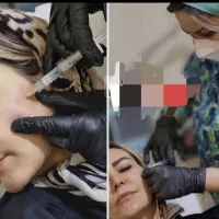 آموزش ژل و بوتاکس حرفه ای از صفرتاصد|خدمات آموزشی|خرم‌آباد, |دیوار