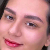 میکروبلیدینگ و فیبروز صورت بدون درد و خونریزی|خدمات آرایشگری و زیبایی|گلبهار, شهر جدید گلبهار|دیوار