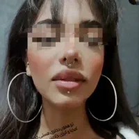 آف ویژه آموزش خدمات پرسینگ میکرودرمال نگین