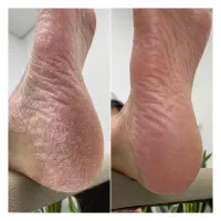 پدیکور درمانی و ریلکسی|خدمات آرایشگری و زیبایی|قائم‌شهر, |دیوار