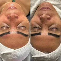 آموزش فوق تخصصی فشیال از مبتدی تا مربی گری