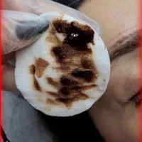 ریمووپاک کردن تتوتاتوابروصورت بدن|خدمات آرایشگری و زیبایی|رشت, فلسطین|دیوار