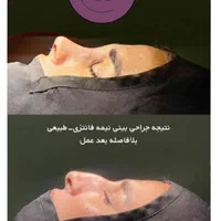 جراحی زیبایی اقساط|خدمات آرایشگری و زیبایی|تهران, امیریه|دیوار
