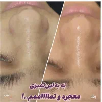 پاکسازی پوست  فقط با ۴۸۰