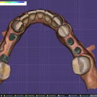 دعوت کارآموز طراحی دیجیتالی لابراتواردندانسازی