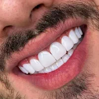 کامپوزیت و دندان پزشکی