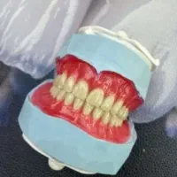 20٪درصد تخفیف دندان مصنوعی