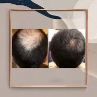 کابل رویش