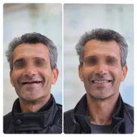 آموزش تخصصی دندانسازی خصوصی و نیمه خصوصی