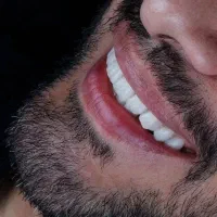 کلیه خدمات دندانپزشکی . زیبایی|خدمات آرایشگری و زیبایی|رشت, گلسار|دیوار