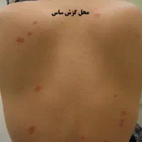 خدمات سمپاشی سیلور