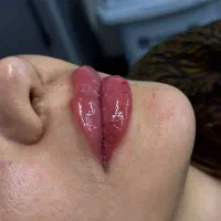 کلینیک تخصصی پوست،مو و زیبایی دکتر فاطمه عروجی|خدمات آرایشگری و زیبایی|تهران, مشیریه|دیوار