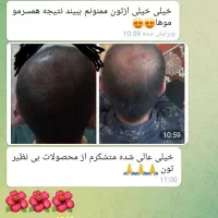 تونیک تقویت کننده مو رشد مجدد|آرایشی، بهداشتی، درمانی|تربتحیدریه, ۴۵ متری|دیوار