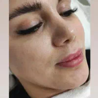 فیشیال صورت آقایان وخانم ها مطب دکتر پروین گودرزی|خدمات آرایشگری و زیبایی|یاسوج, |دیوار