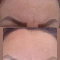 کرم 5 کاره بوتاکس طبیعی|خدمات آرایشگری و زیبایی|گنبد کاووس, |دیوار