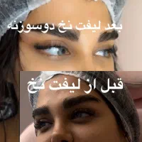 بوتاکس پارتی کلینیک زیبایی و جراحی