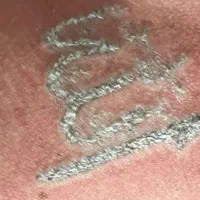 ریمو تتو و روشن سازی نواحی تیره