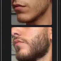 مو و ریش