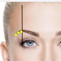 مدل برای تزریق ژل و بوتاکس لازم داریم